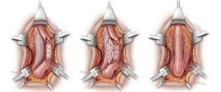 Urologie Reconstructiva la Moscova