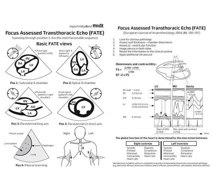 Регионална анестезия под ехографски - ехокардиография в анестезия (съдба, треска)
