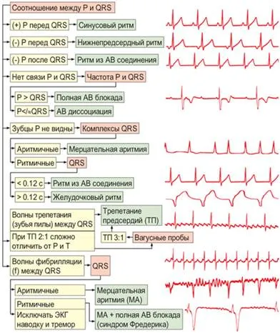 Elemzése és értelmezése EKG