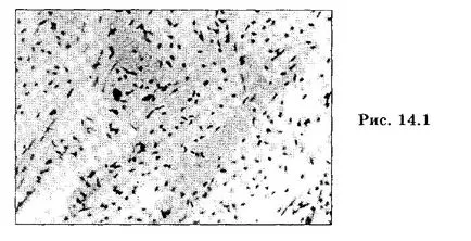 Anatomia și Histologie a pulpei dentare