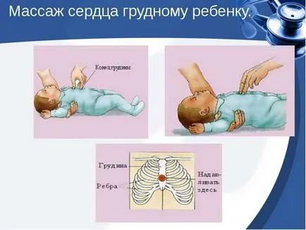 Algoritmul de resuscitare cardiopulmonară la copii și pentru adulți CPR și de prim ajutor, okeydok