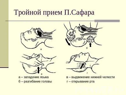 Algoritmul de resuscitare cardiopulmonară la copii și pentru adulți CPR și de prim ajutor, okeydok