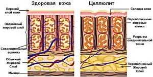 Антицелулитен обвиване на тялото в домашни условия рецепти