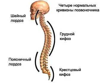 Scheuermann boala-Mau - cauze, simptome, tratament