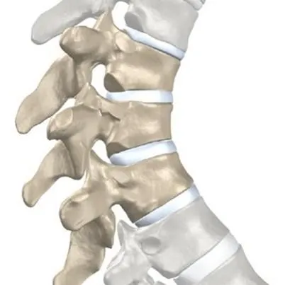 Scheuermann boala-Mau - cauze, simptome, tratament