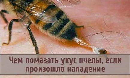 В помаже ужилване от пчела, ако е имало нападение на насекоми