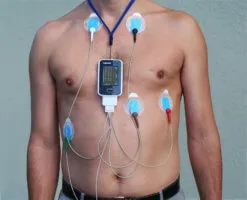 Mi szív EKG Holter bizonyíték, az eljárás és módszer előnyeit