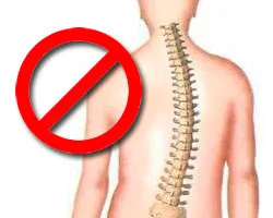 Не Какво да правим при сколиоза противопоказания