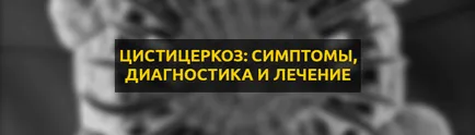 Simptomele Cysticercosis, diagnosticul și tratamentul bolilor