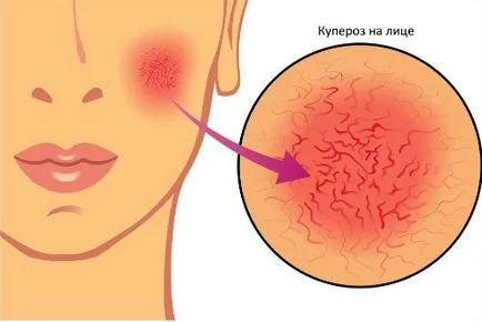 Ако по лицето на спукването на кораба е причината, как да се отнасяме списание за жени