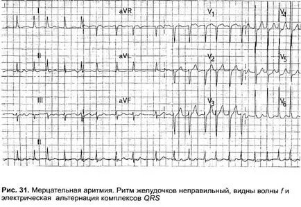 Bazele electrofiziologice ECG