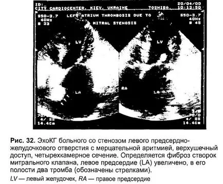 Bazele electrofiziologice ECG