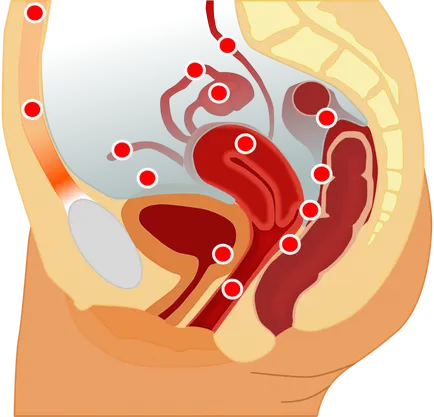 Tratamentul endometrioza determină un jurnal online