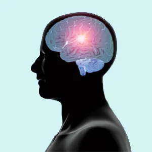 gliom cerebral - tratament in centrul onkostop radioterapie