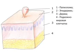 Как да се разграничи мол на папилома