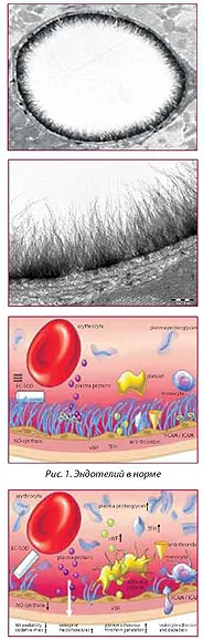 Semnificația clinică a disfuncției endoteliale în chirurgia