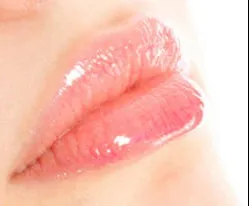 Corectarea conturului buzelor, corectarea asimetriei și întinerire a buzelor, marirea buzelor