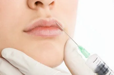 Корекция на контура на устните, коригиране на асиметрия и подмладяване на устните, увеличаване на устните