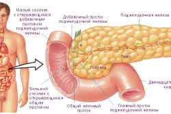 Tratamentul chist pancreatic
