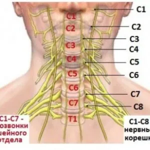 Tratamentul coloanei vertebrale cervicale herniat (foto, video)