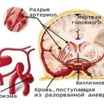 Съпруг напитки, които правят Психолог съветва жените до алкохолно