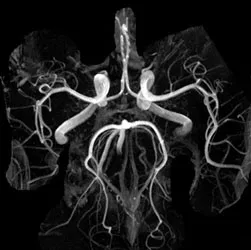 MRI на сърцето и коронарните артерии - цената на сърдечна ЯМР с контраст