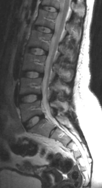 MRI на гръбначния стълб в Нижни Новгород