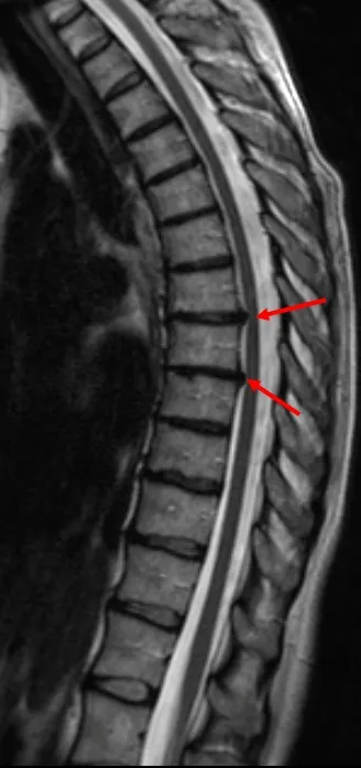 MRI на гръбначния стълб в Нижни Новгород