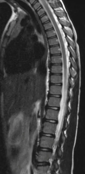 MRI a gerinc Nyizsnyij Novgorodban