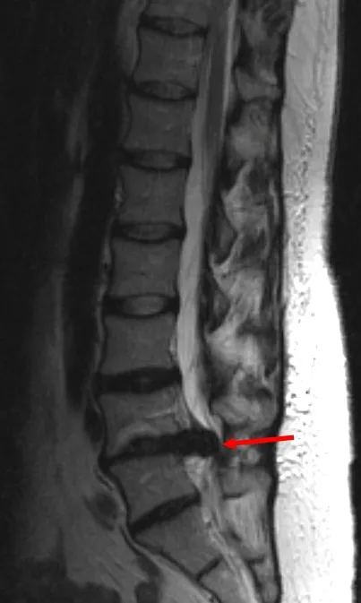 MRI на гръбначния стълб в Нижни Новгород