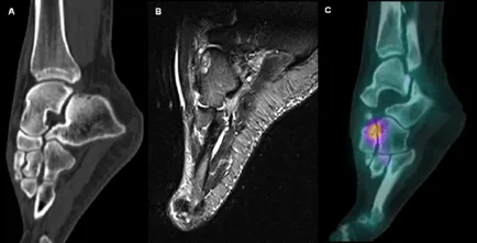 MRI a láb