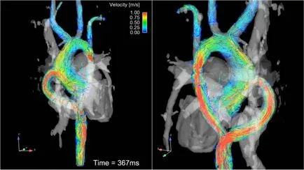 MRI на сърцето - това показва цената