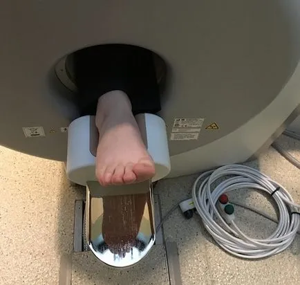 MRI на крака