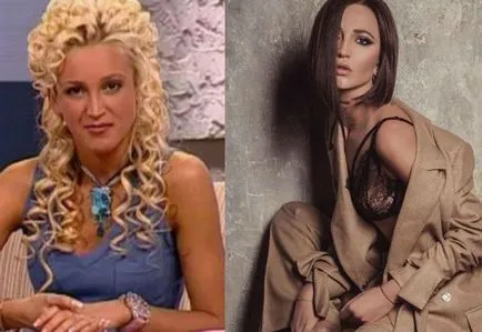 Olga Buzova előtt és után műanyag műveletek (fotó)