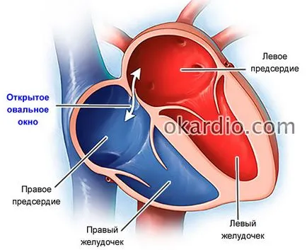 murmur cardiac la nou-nascuti cauze, tipuri, diagnostic și tratament