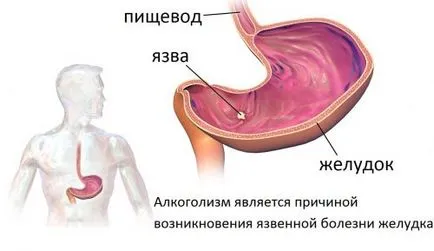 Dupa ce au baut dureri de stomac pentru a face