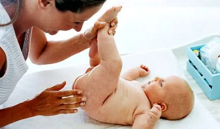 Sudamen tünetek és a kezelés az újszülött, típusairól és okairól a terjedését a kiütés