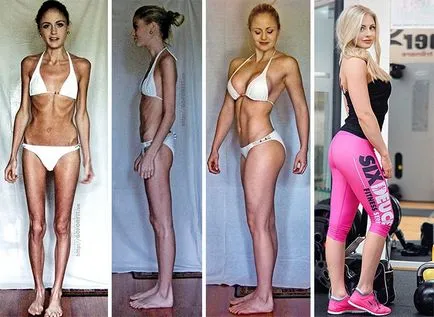 Lenyűgöző hasznosítás az emberek előtt és után anorexia umkra