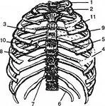 defect Rib-musculare - sindromul Polonia