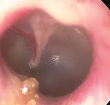 Dezvoltarea de endoscopie in medicina veterinara