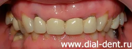 proteze dentare Complex - o abordare integrată a „dial-dent“