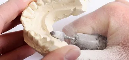 Repararea de proteze în stomatologie și ilatan