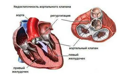 murmur cardiac la un copil cauze și diagnostic