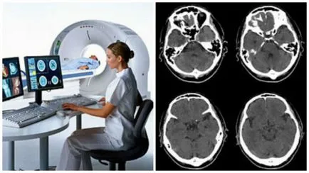 Ceea ce este mai bun - RMN sau CT lecturi ale creierului și caracteristici esențiale
