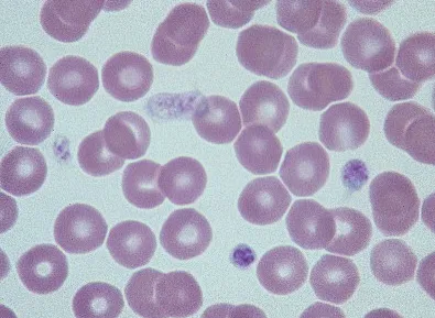 Thrombocytopenia kutyák