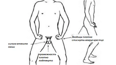 Gyakorlat krónikus prostatitis testedzés és néhány terápiás gyakorlatok és