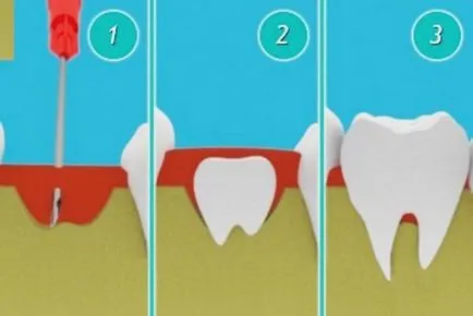 Отглеждане на зъбите в човешката технология и техники, като очакваната цена
