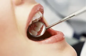 Dentist si terapeut dentare modul in care acestea difera si ceea ce fac