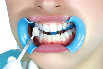 Централна Dental избелване и почистване на зъби в Челябинск