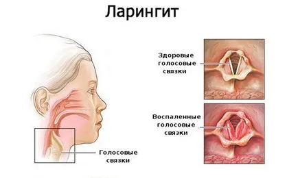 Това би трябвало да даде на бебето от годината на лекарства за кашлица и рецепти